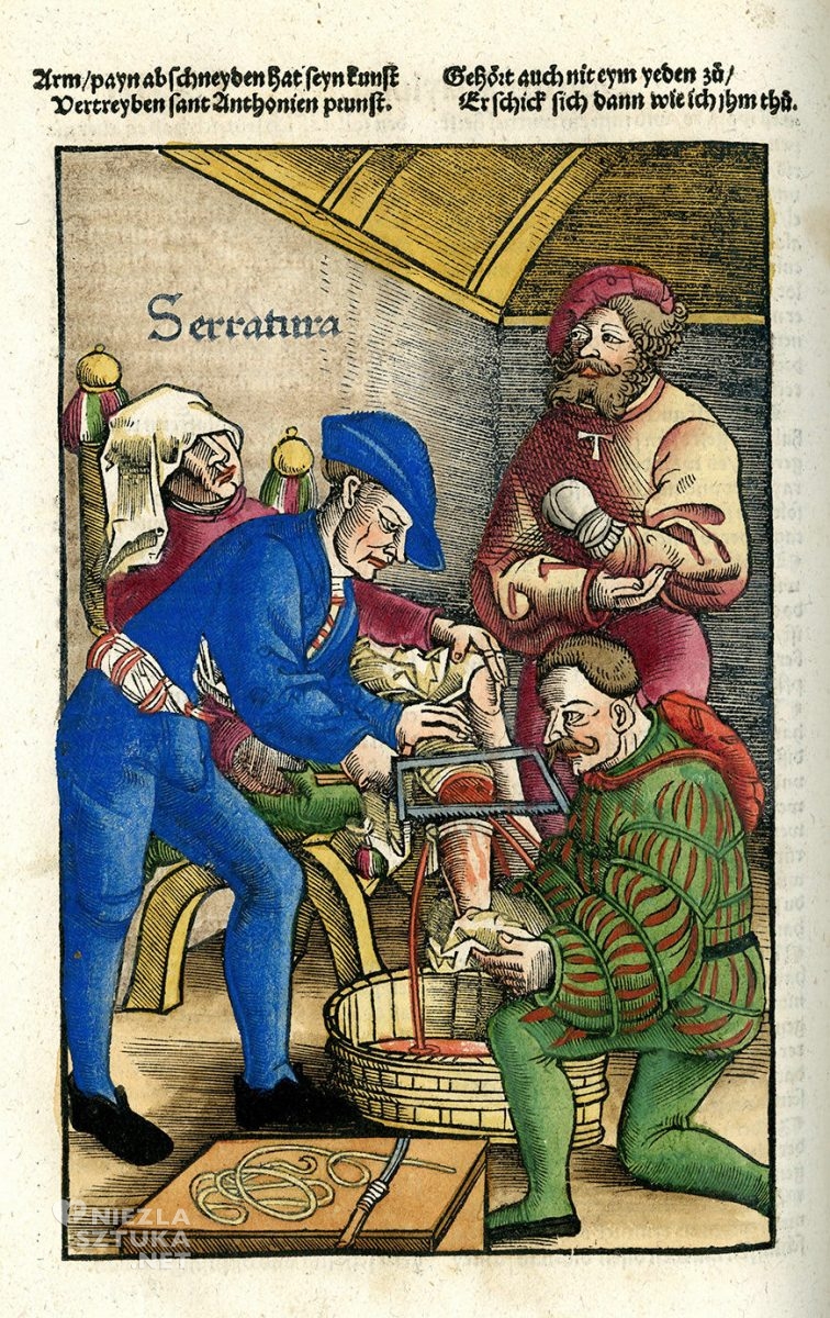 Feldbuch der Wundartznei, Hans von Gersdorff, średniowiecze, medycyna, Niezła Sztuka