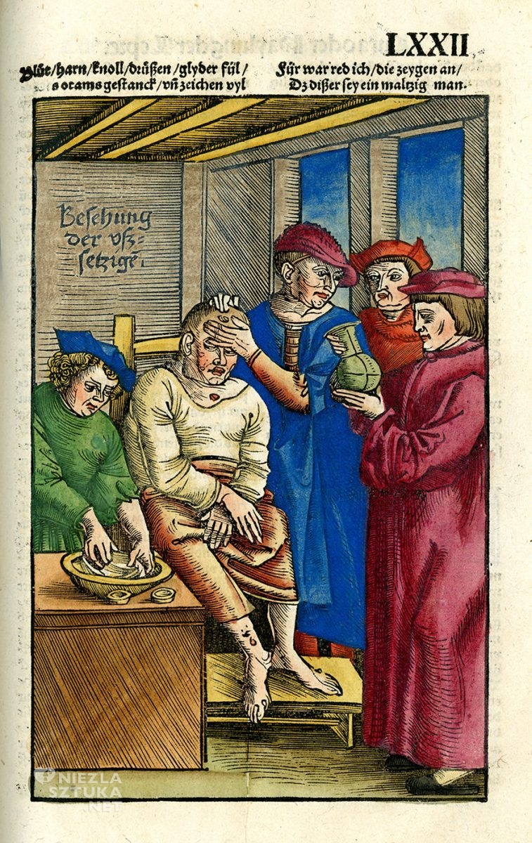 Feldbuch der Wundartznei, Hans von Gersdorff, średniowiecze, medycyna, Niezła Sztuka