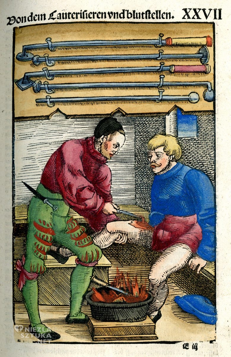 Feldbuch der Wundartznei, Hans von Gersdorff, średniowiecze, medycyna, Niezła Sztuka