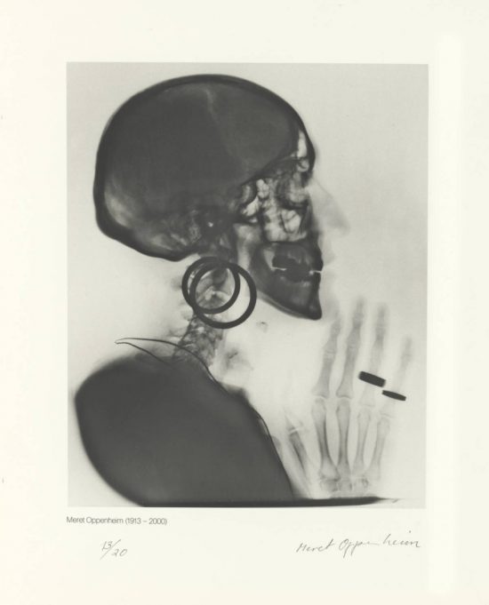 Meret Oppenheim, X-ray, Rentgen czaski M.O., sztuka współczesna, kobiety w sztuce, Niezła Sztuka